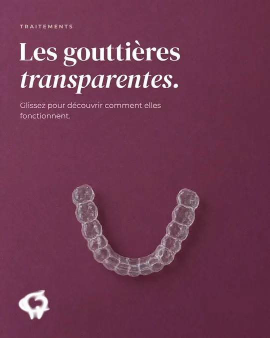 Publication du Docteur Fejes sur les gouttières transparentes, sur fond prune